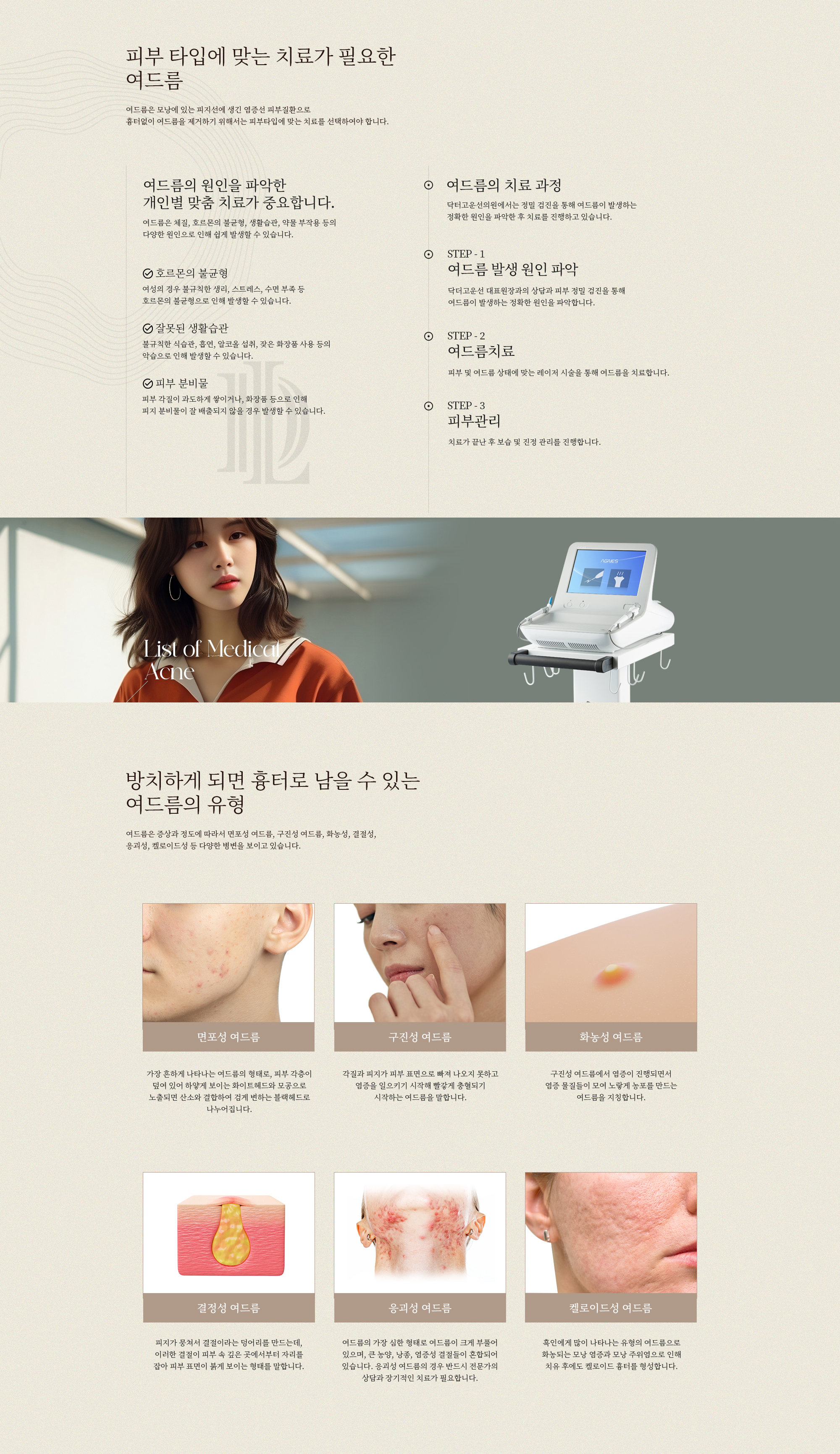 여드름